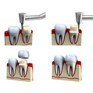 smileplzzz dental clinic